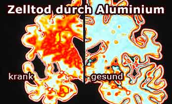 Der Virus Wahn Viruswahn