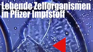 PFIZER CORONA-IMPFSTOFF MIKROSKOPISCH VERGRÖSSERT- LEBENDIGER MIKROORGANISMUS ENTDECKT! Mikroorganismen in Impfstoff